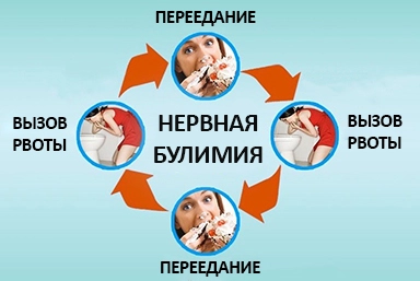 Лечение булимии в Полярных Зорях